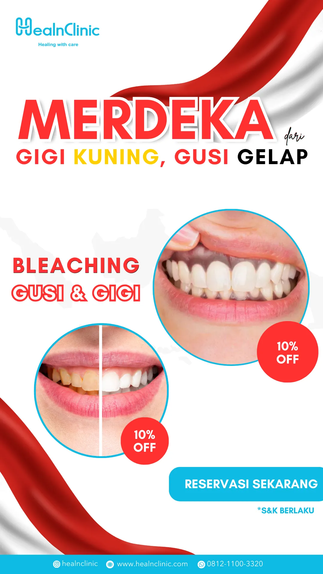Behel Gigi Conventional Metal