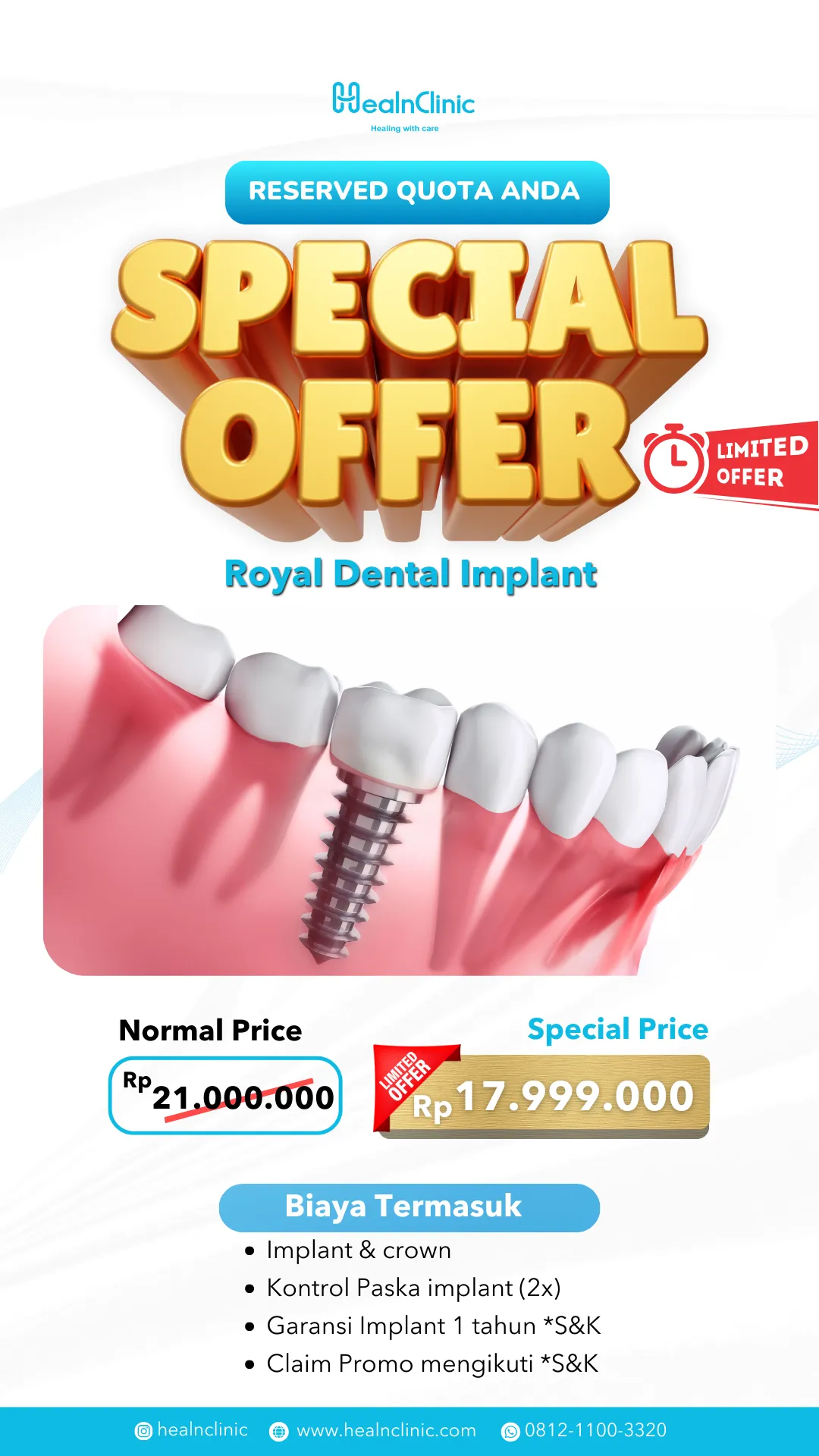 Dental Braces & Implant